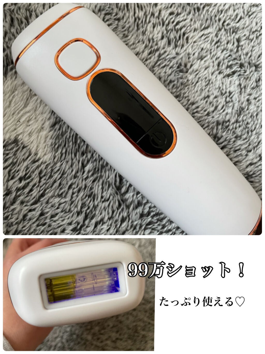 beyda IPL光脱毛器/beyda/家庭用脱毛器を使ったクチコミ(2枚目)