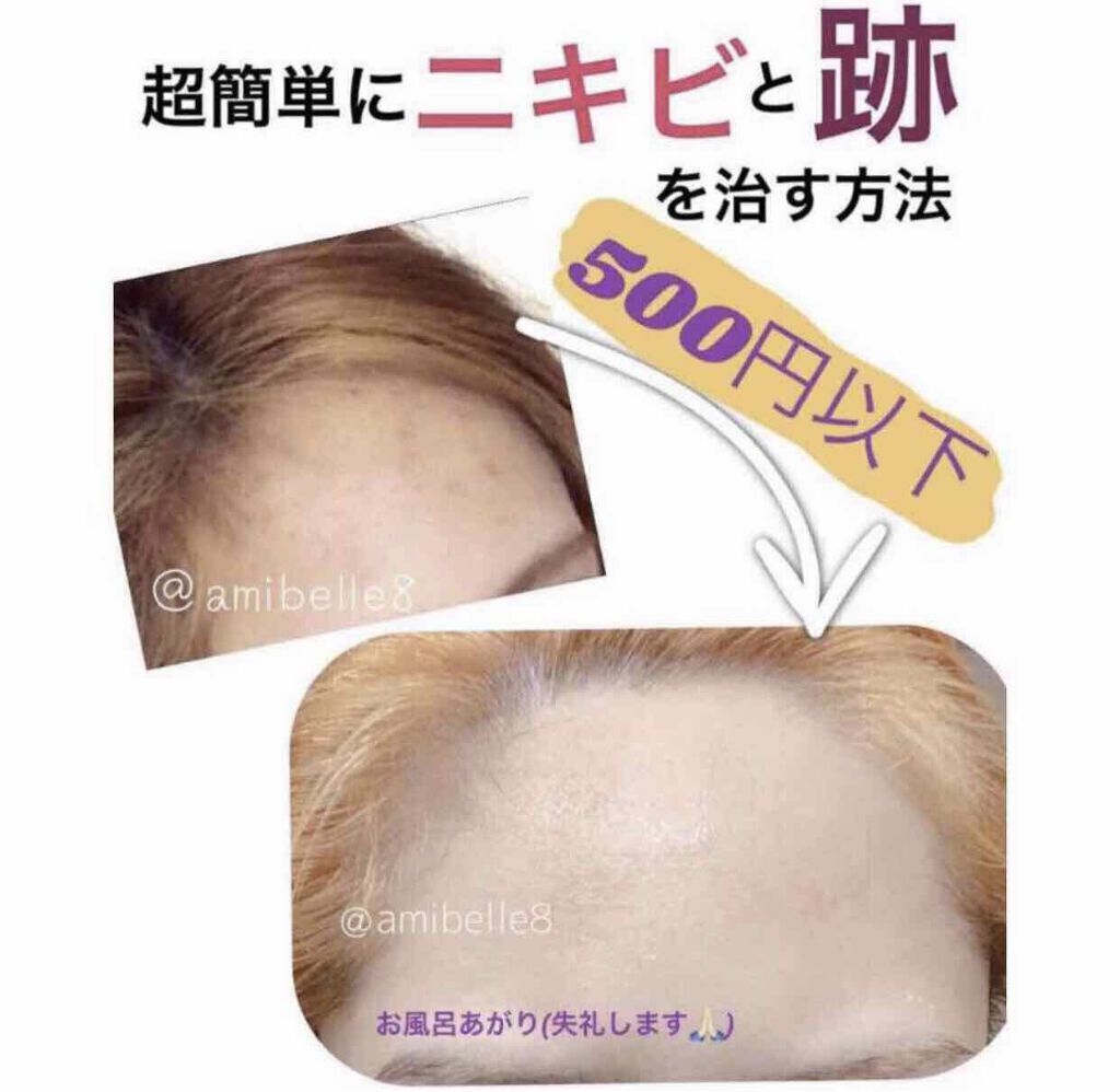 薬用洗顔フォーム/スキンライフ/洗顔フォームを使ったクチコミ(2枚目)