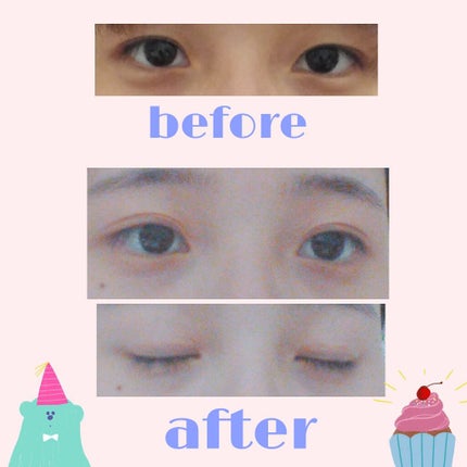 アイテープ片面(のびる)絆創膏タイプ スリム 120枚/セリア/二重まぶた用アイテムを使ったクチコミ(2枚目)