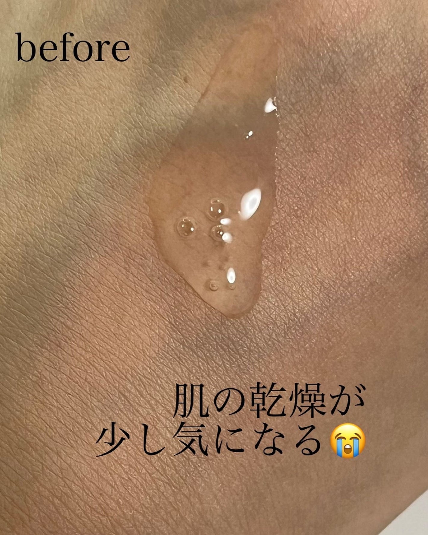 HA Boosting Serum /NATURAL DERMA PROJECT/ブースター・導入液を使ったクチコミ(4枚目)
