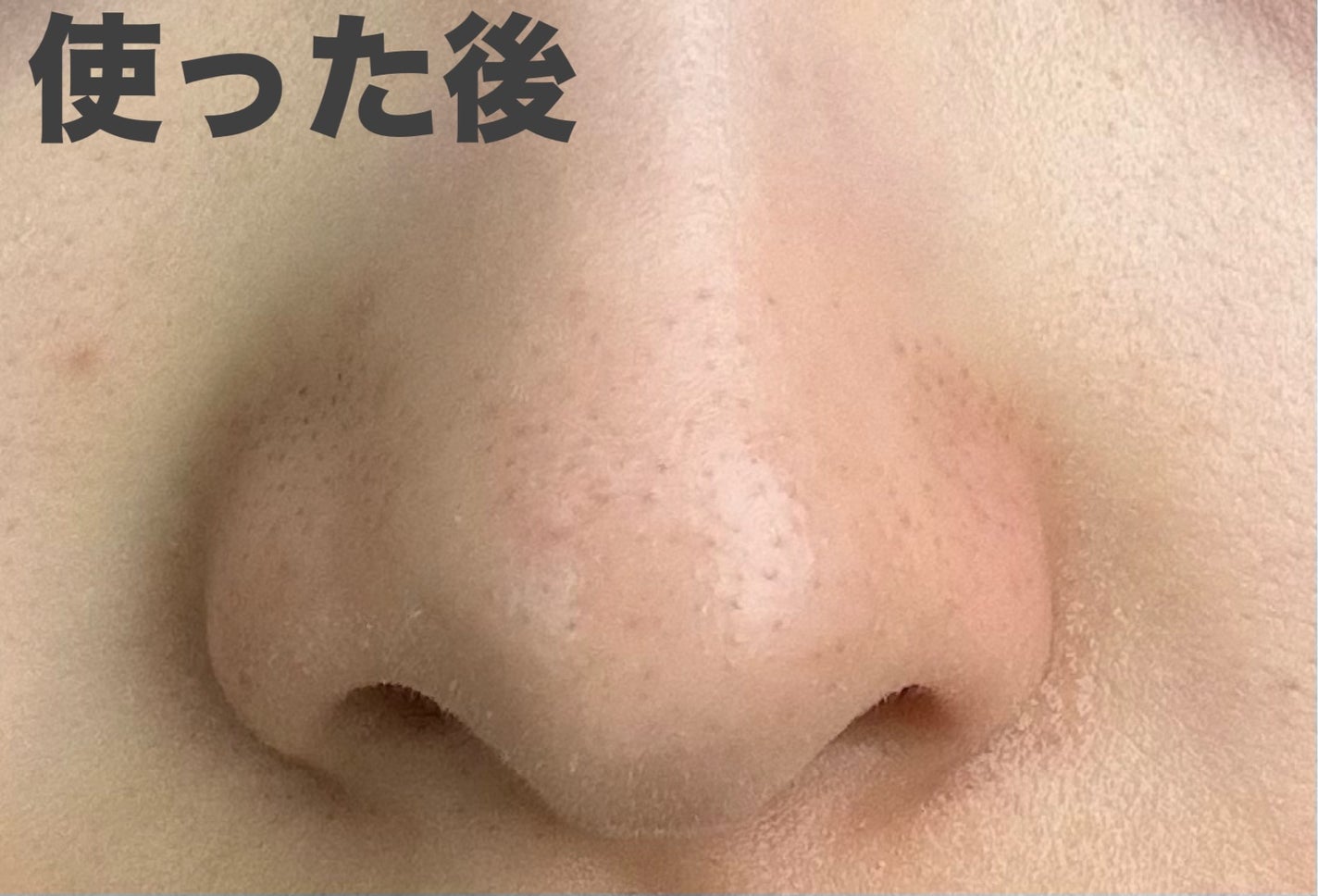 ゼロ毛穴パッド 2.0/MEDICUBE/トナーパッドを使ったクチコミ(3枚目)