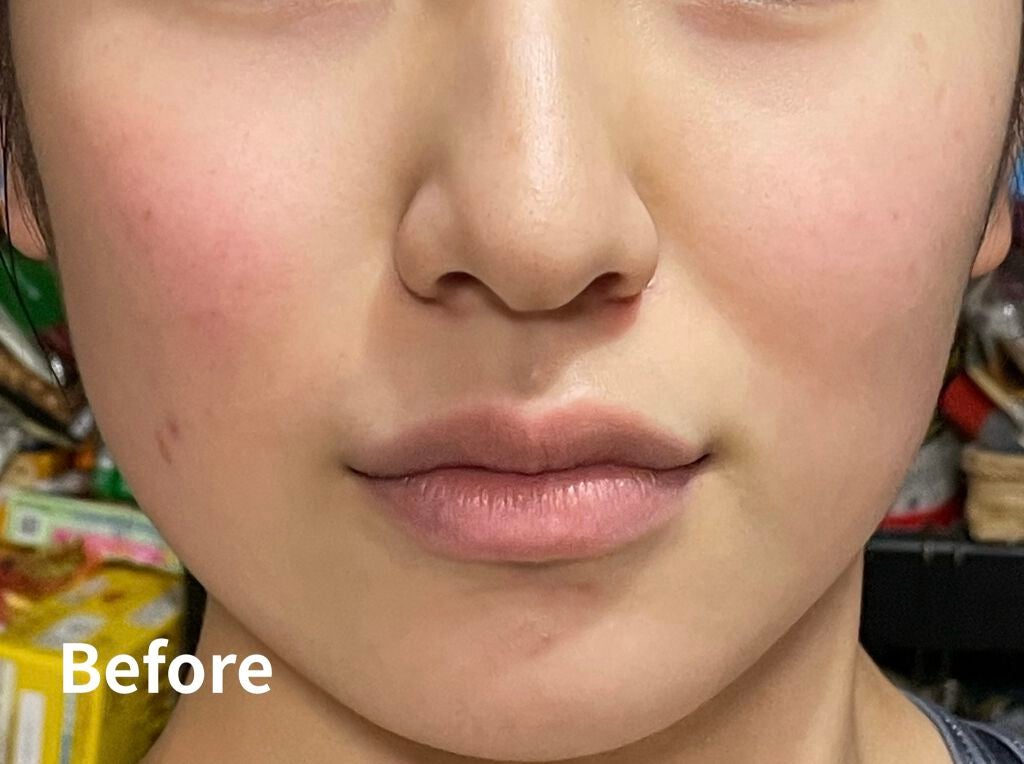 毛穴小町マスク /クリアターン/シートマスク・パックを使ったクチコミ(4枚目)