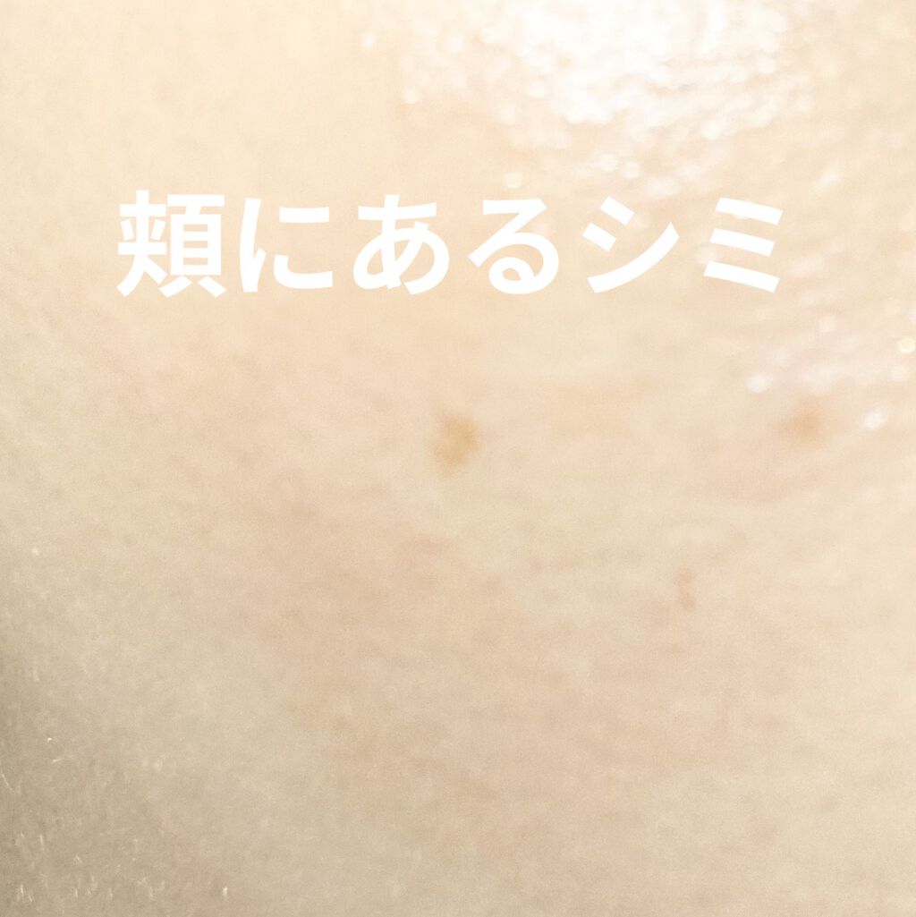 EUKROMA Plus/EUKROMA/その他スキンケアを使ったクチコミ（2枚目）