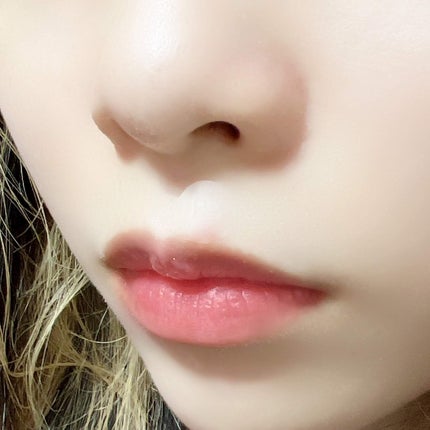 極薄透明パッチ nikipa!/金冠堂/にきびパッチを使ったクチコミ(4枚目)