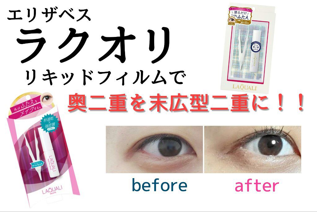 リキッドフィルム/ラクオリ/二重まぶた用アイテムを使ったクチコミ(1枚目)