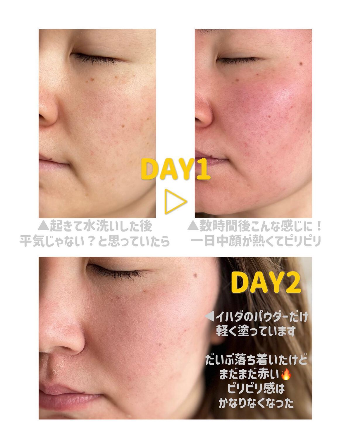 ダーマスキンピーリング|BQCELLの使い方を徹底解説 - \メガ割