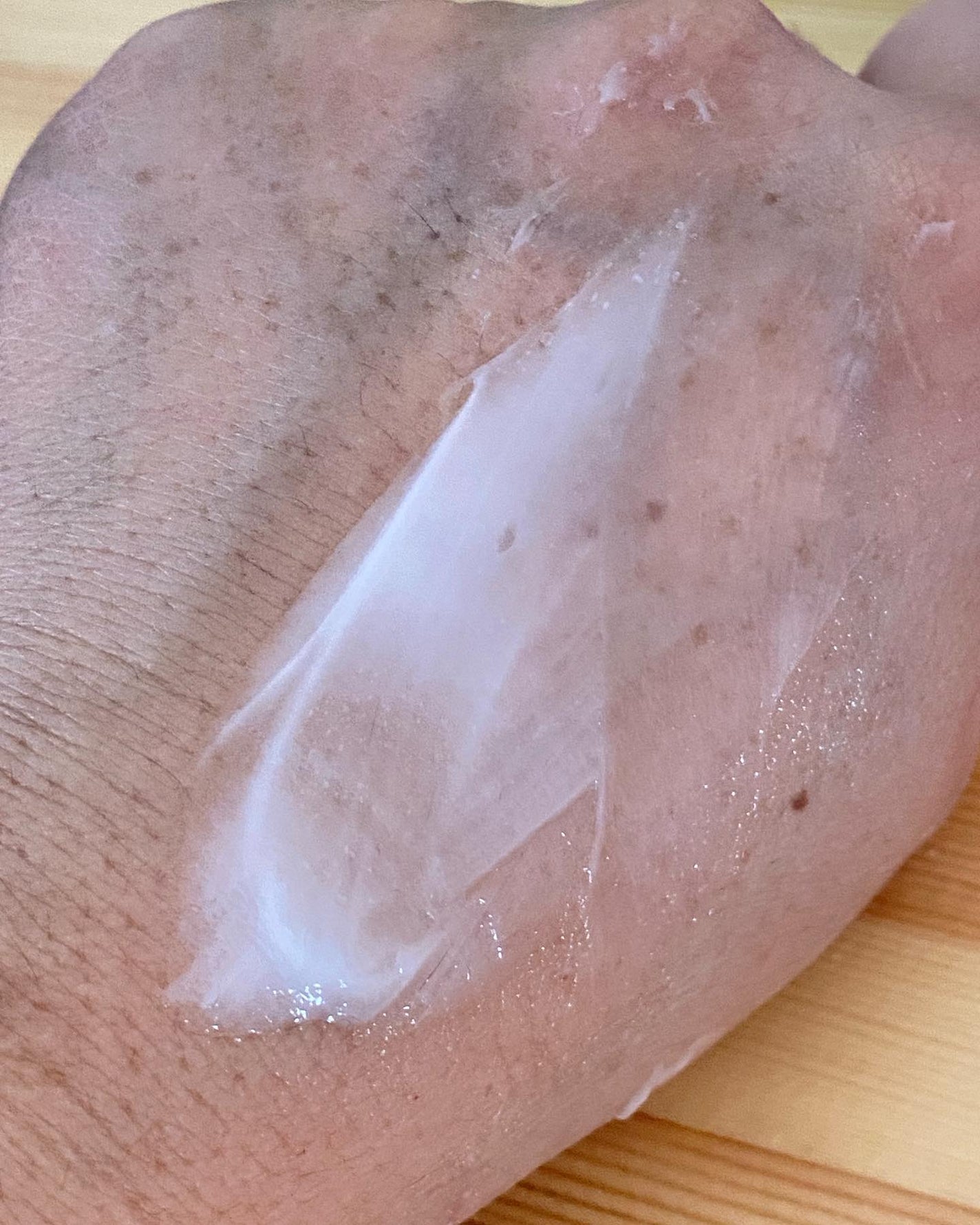 薬用リンクルホワイトクリーム/明色/フェイスクリームを使ったクチコミ(6枚目)