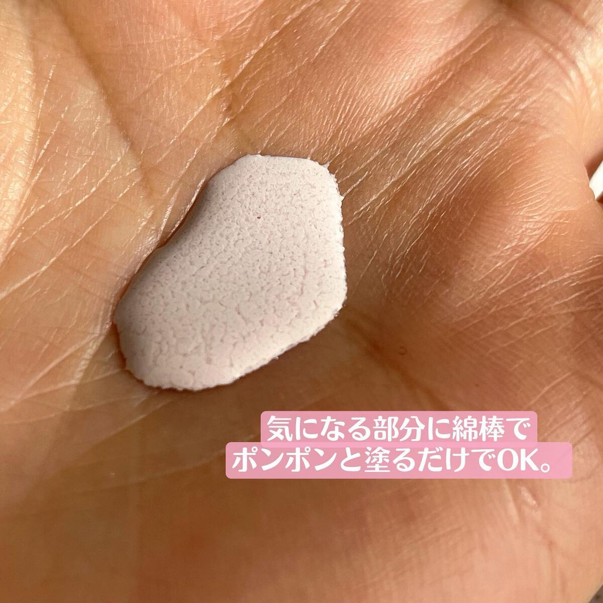 ピンクパウダースポットトリートメント/EUYIRA/その他スキンケアを使ったクチコミ(5枚目)