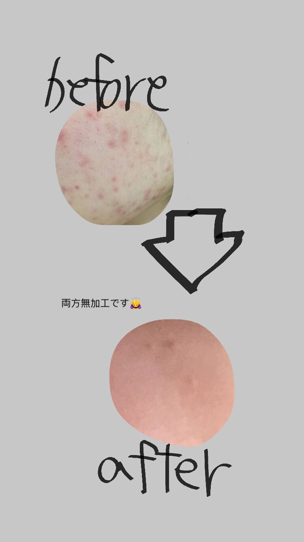 を使ったクチコミ（1枚目）