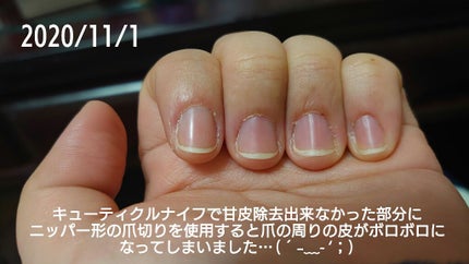 ディープセラム/Dr.Nail/ネイルオイル・トリートメントを使ったクチコミ(6枚目)