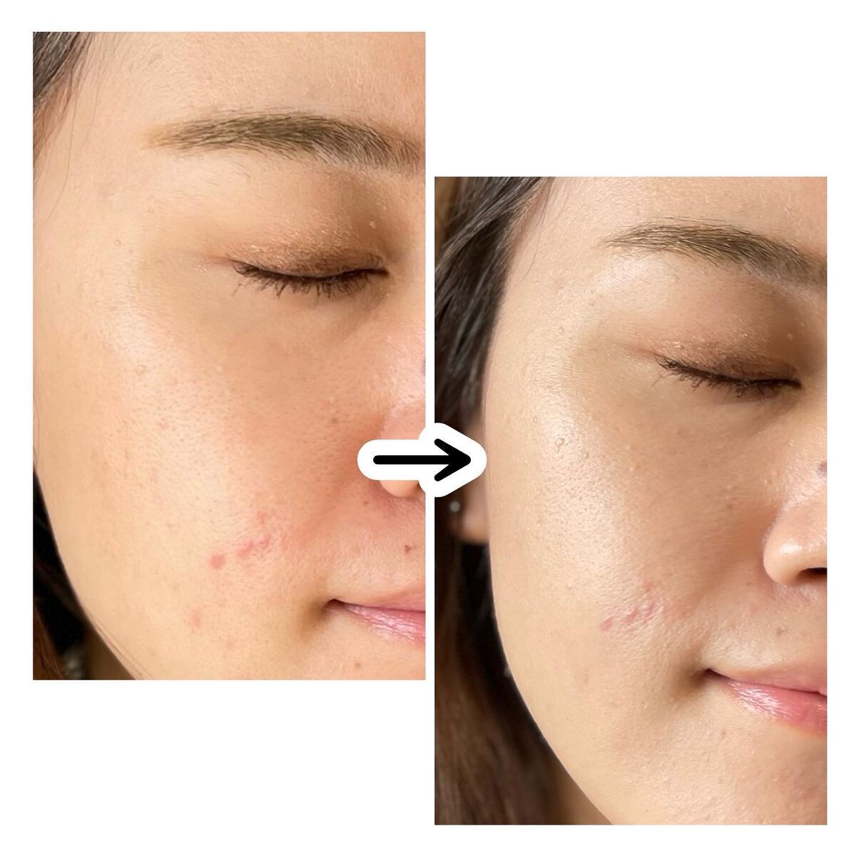 ロングラスティングマットカバークッション/Milk Touch/クッションファンデーションを使ったクチコミ(5枚目)