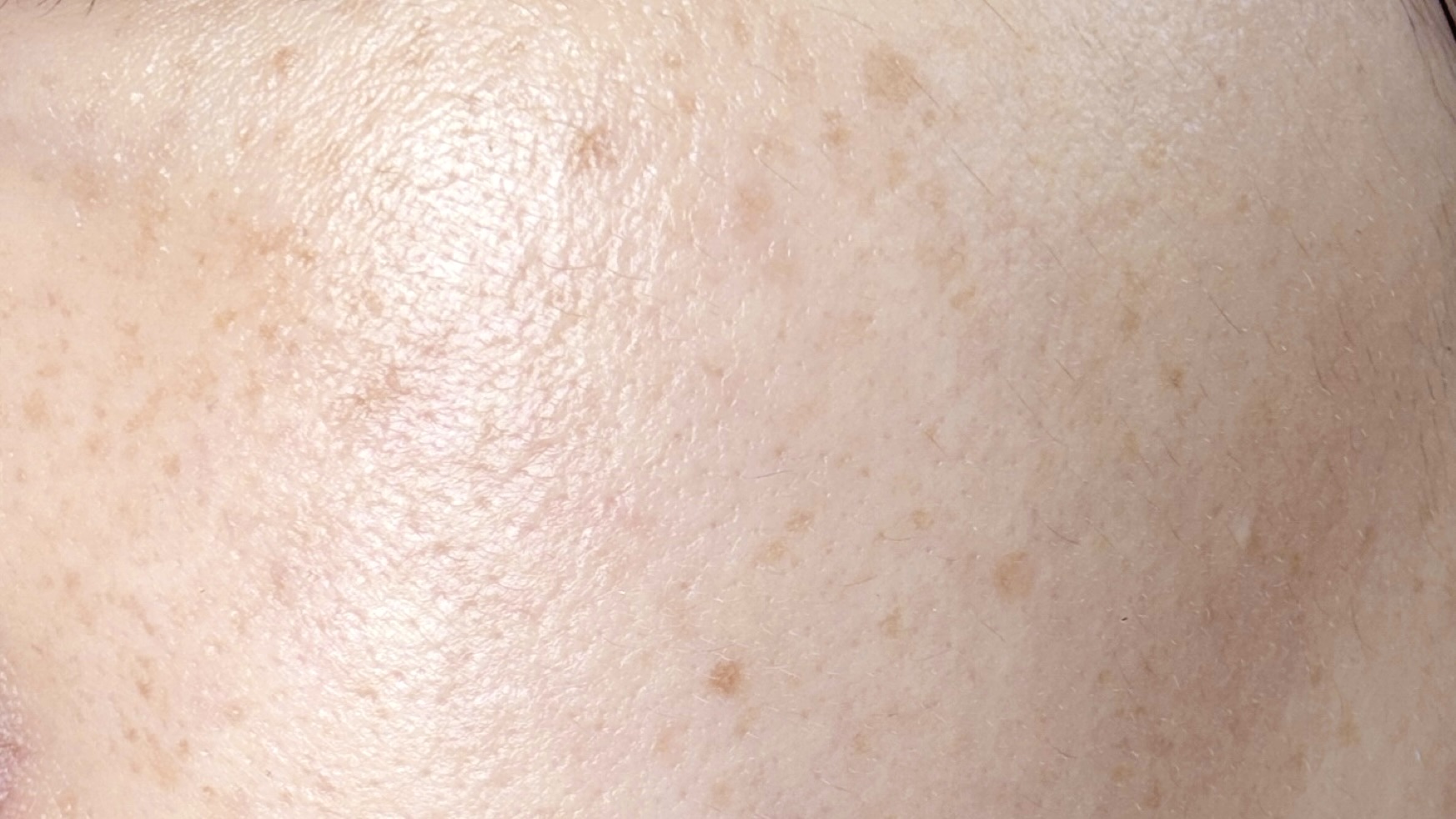 エリクシール シュペリエル デーケアレボリューション T+/エリクシール/乳液を使ったクチコミ（3枚目）