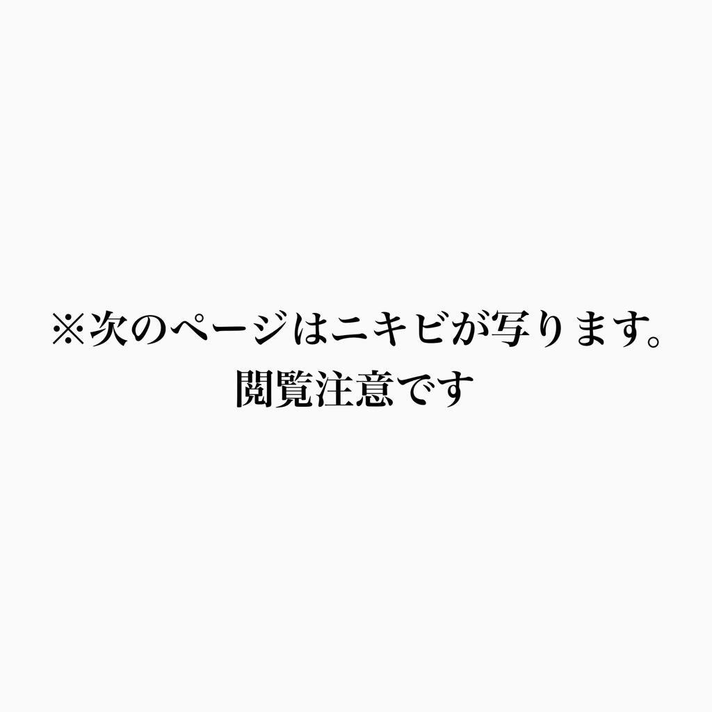 薬用ふわふわな泡洗顔/メンソレータム アクネス/泡洗顔を使ったクチコミ(2枚目)