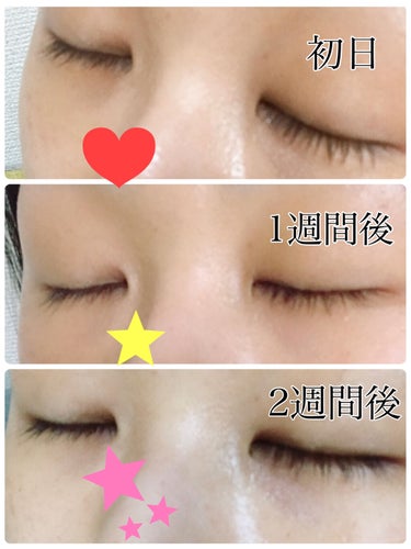 NANOA SC Eyelash Serum ヒト幹細胞まつ毛美容液/NANOA/まつげ美容液を使ったクチコミ（3枚目）