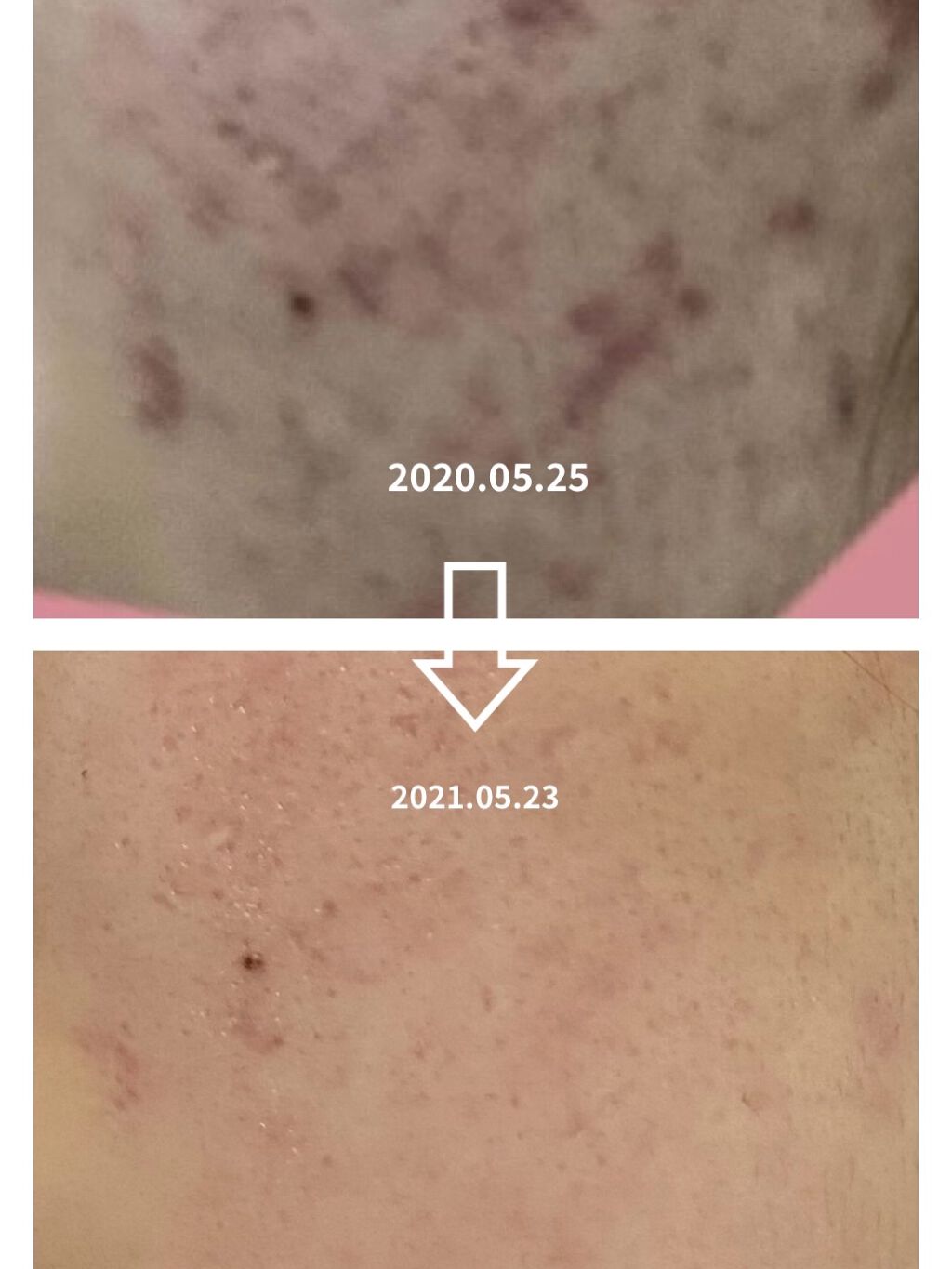 を使ったクチコミ（1枚目）