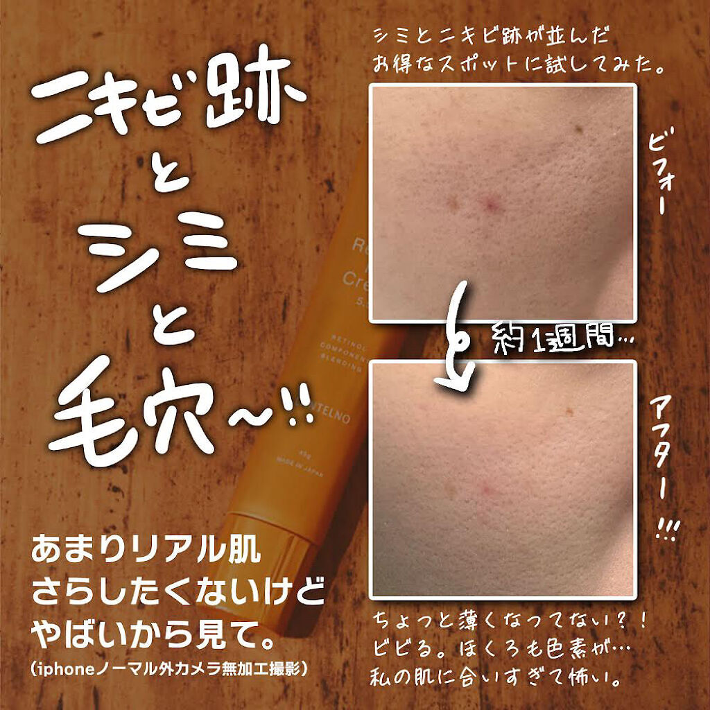 LANTELNO RTクリーム5.5/LANTELNO/フェイスクリームを使ったクチコミ（3枚目）