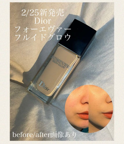 ディオールスキン フォーエヴァー フルイド グロウ/Dior/リキッドファンデーションを使ったクチコミ(1枚目)
