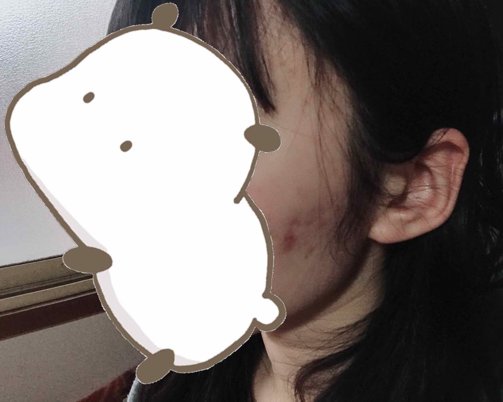 アロマウォーター/ラッシュ/ミスト状化粧水を使ったクチコミ（2枚目）