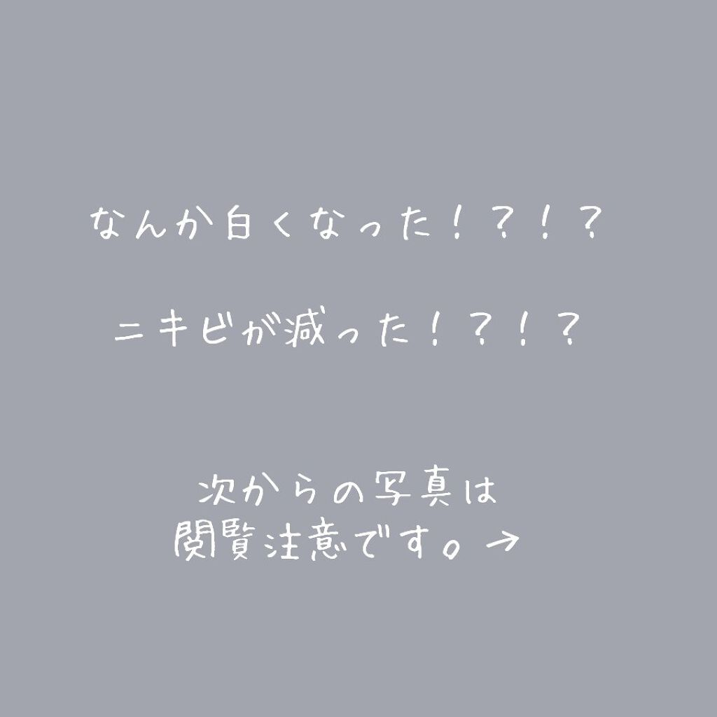 チョコラBBピュア (医薬品)/チョコラBB/その他を使ったクチコミ（1枚目）