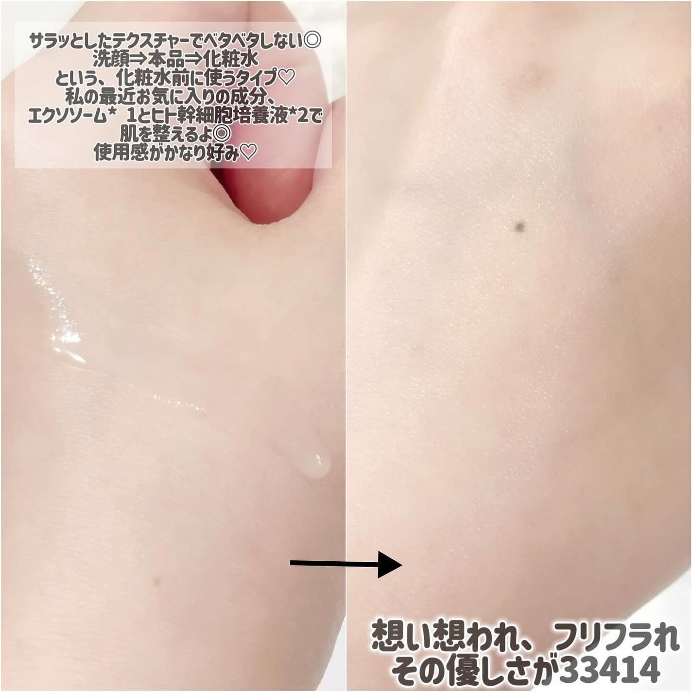 その優しさが33414/想い想われ、フリフラれ。/美容液を使ったクチコミ(3枚目)