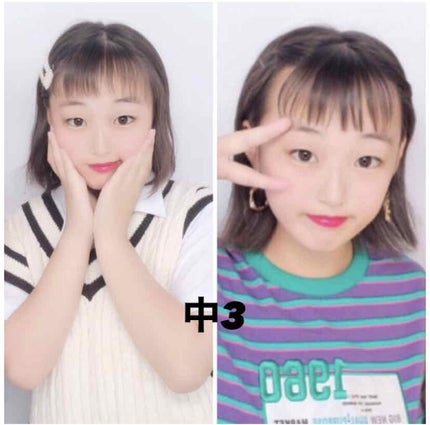 アイテープ(絆創膏タイプ、レギュラー、70枚)/DAISO/二重まぶた用アイテムを使ったクチコミ(2枚目)