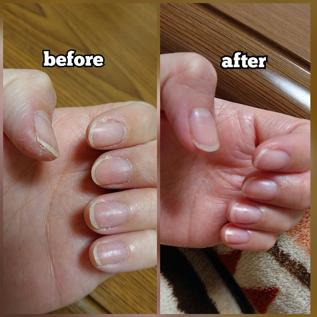 ゆびさき&ネイルケアパック/DAISO/ネイル用品を使ったクチコミ(2枚目)