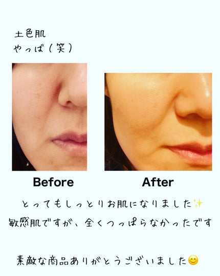 シルクリオ フローラ 洗顔お試し3点セット/ホロスリン製薬/トライアルキットを使ったクチコミ(8枚目)