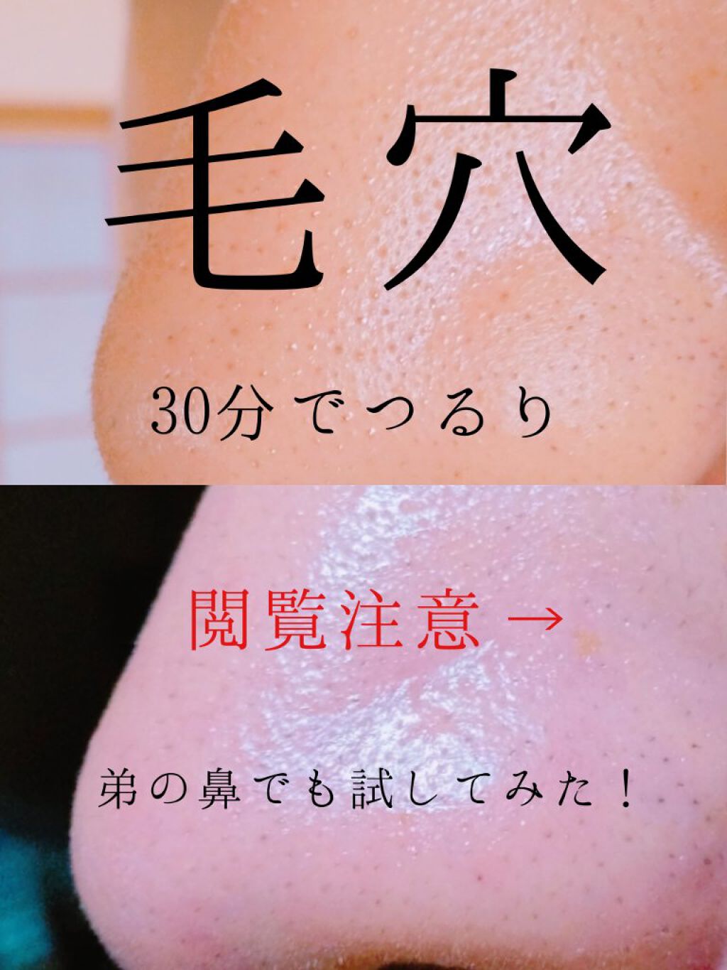 シラクル ビューティシート/Ciracle/トナーパッドを使ったクチコミ（1枚目）