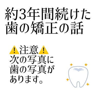 クリニカアドバンテージ ハミガキ/クリニカ/歯磨き粉を使ったクチコミ（1枚目）