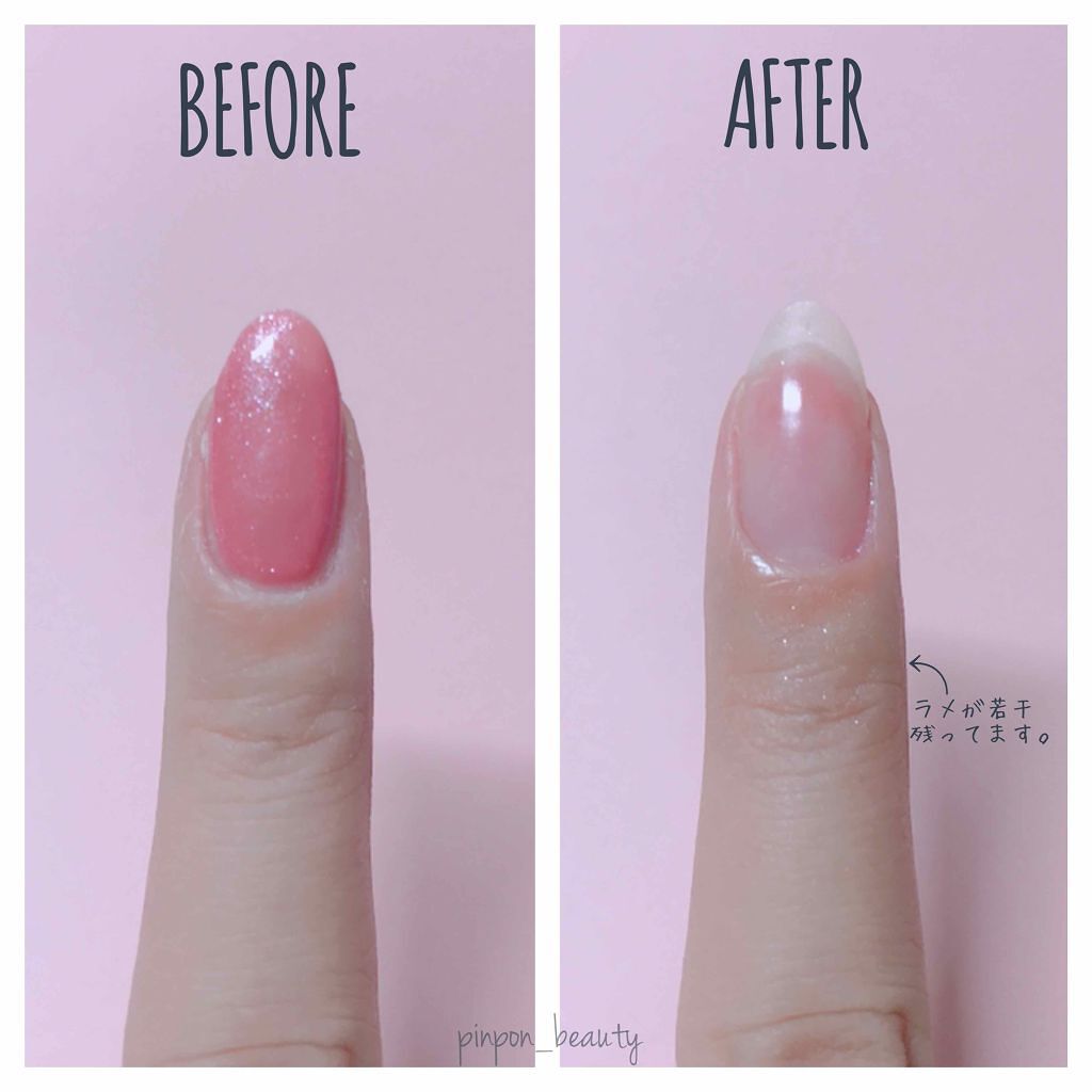 クイックリムーバースポンジイン/パラドゥ/除光液を使ったクチコミ（1枚目）