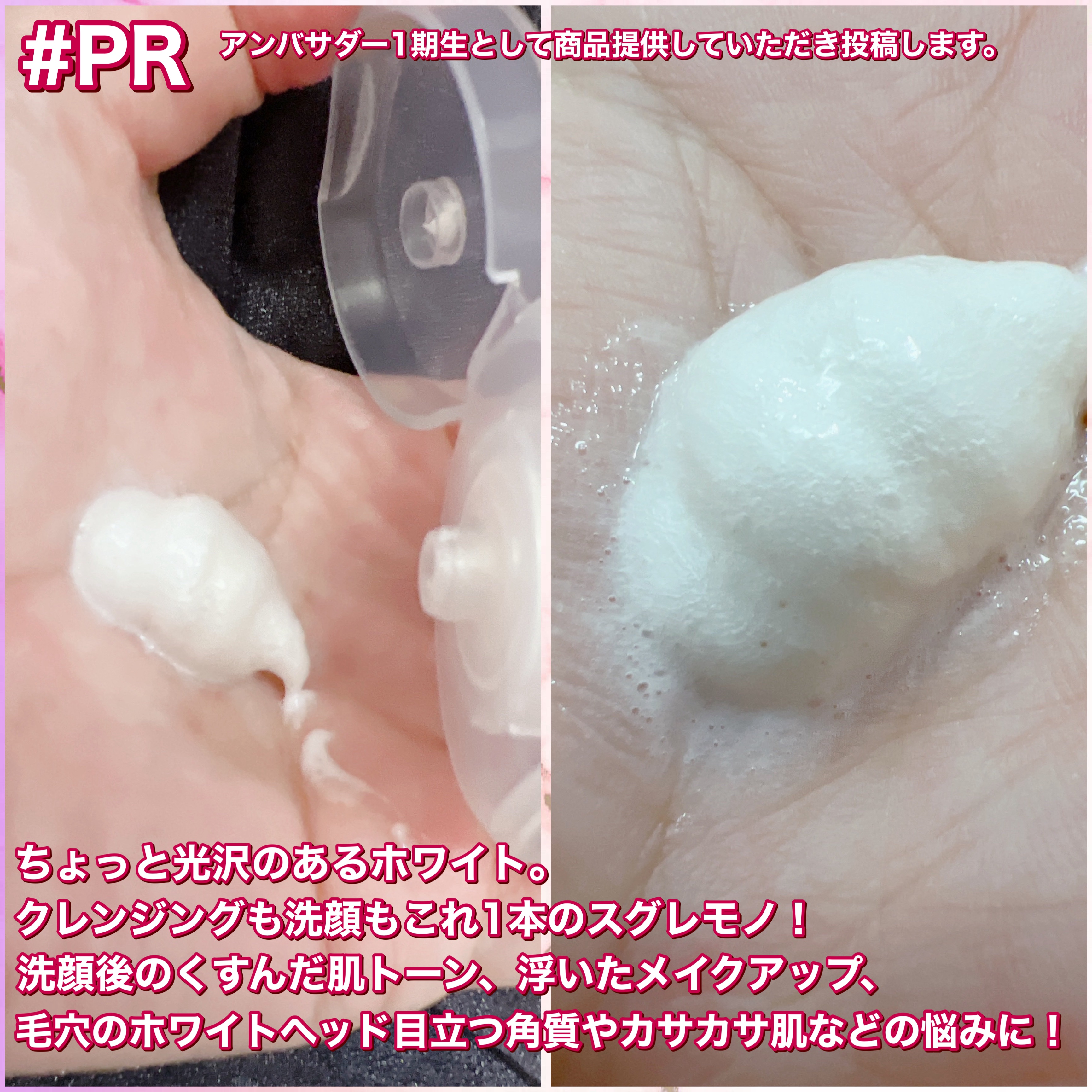 ガスールフォームクレンザー/Bonajour/その他洗顔料を使ったクチコミ（2枚目）