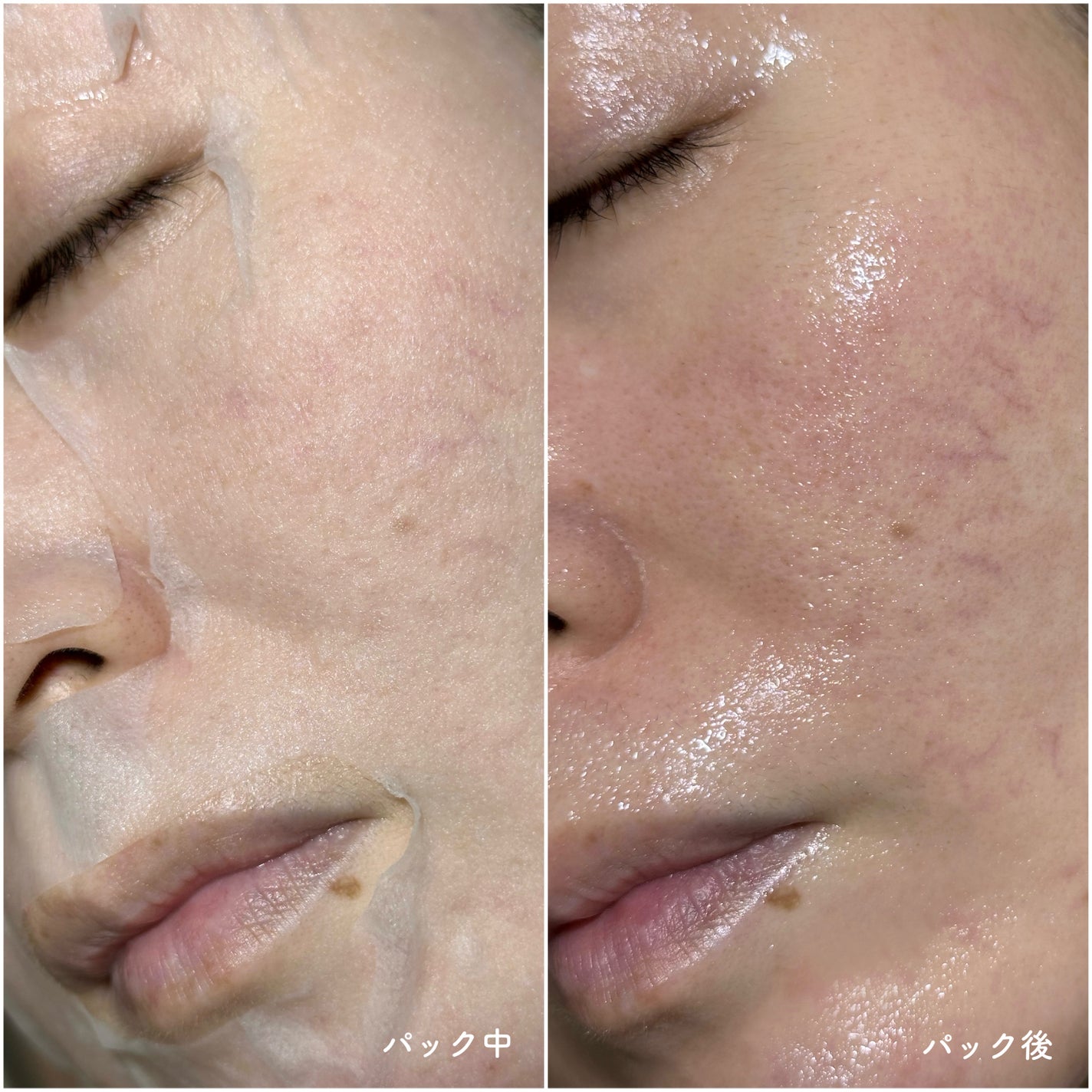 AZケア マスク/VT/シートマスク・パックを使ったクチコミ(4枚目)