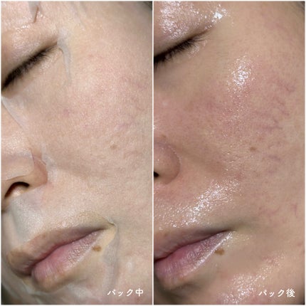 AZケア マスク/VT/シートマスク・パックを使ったクチコミ(4枚目)