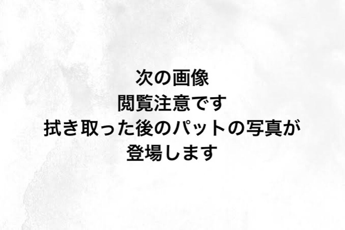 ティーツリーカーミングエッセンスパッド/MEDIHEAL/トナーパッドを使ったクチコミ(4枚目)
