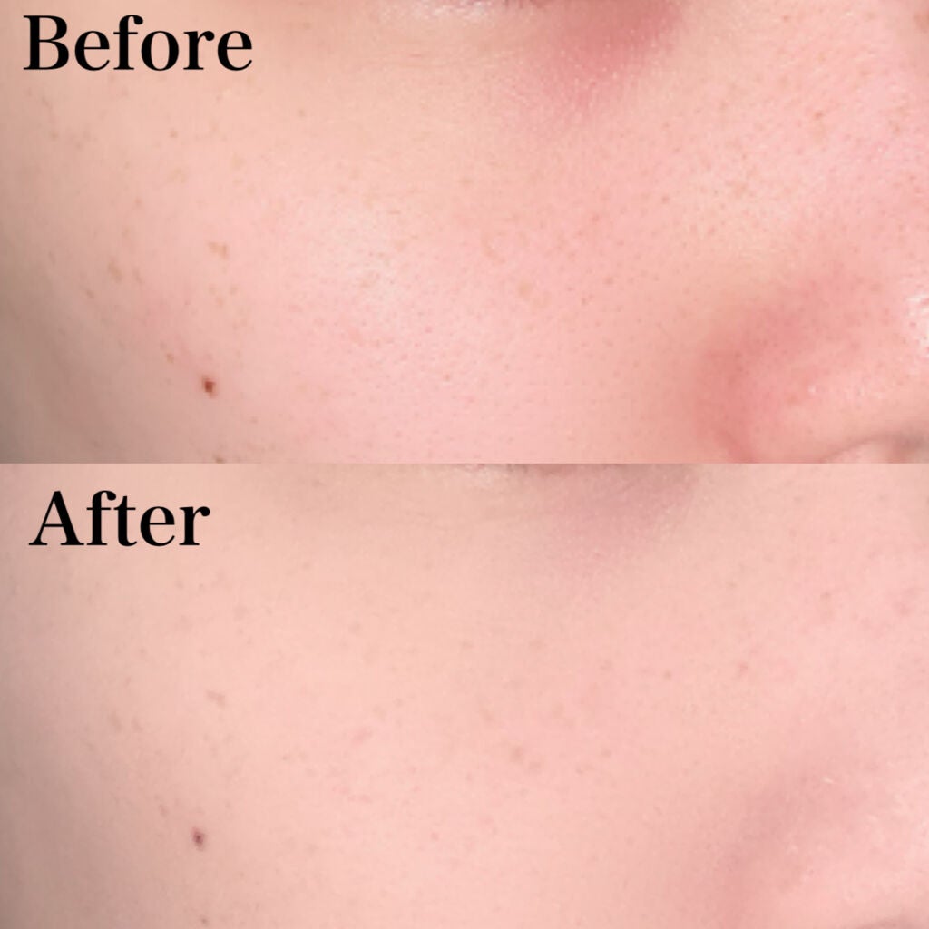 ドラマティックフェイスパウダー/マキアージュ/プレストパウダーを使ったクチコミ(3枚目)