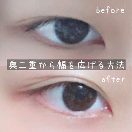 オリシキ アイリッドスキンフィルム		/D-UP/二重まぶた用アイテムを使ったクチコミ(1枚目)