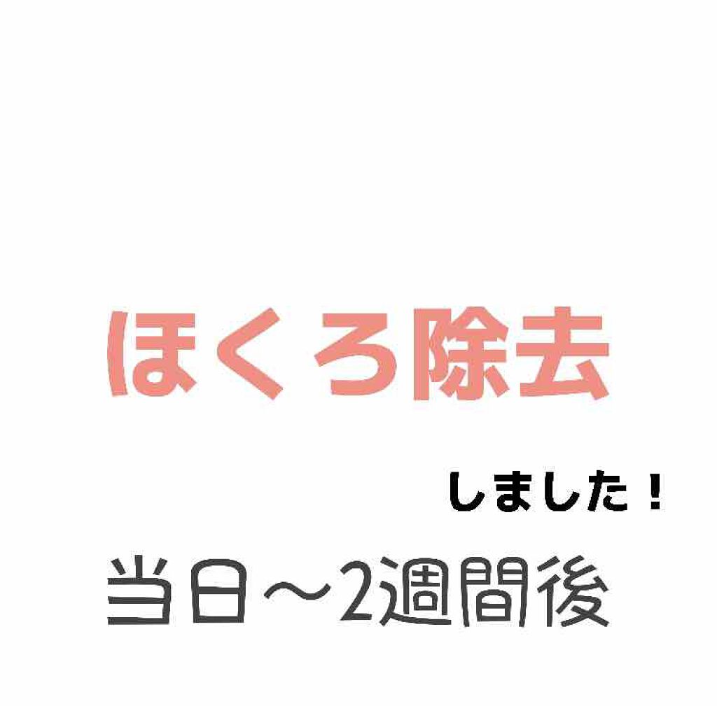 うい on LIPS 「ほくろ除去しました!!2枚目スライド注意です!2枚目の写真は右..」(1枚目)