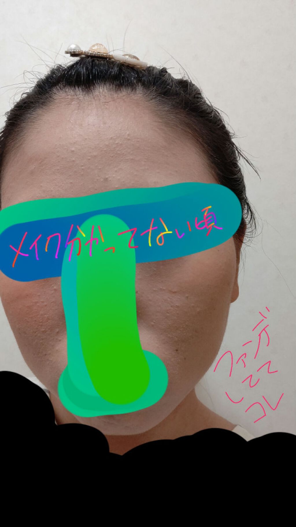 スマートセット/プロアクティブ/スキンケアキットを使ったクチコミ(3枚目)