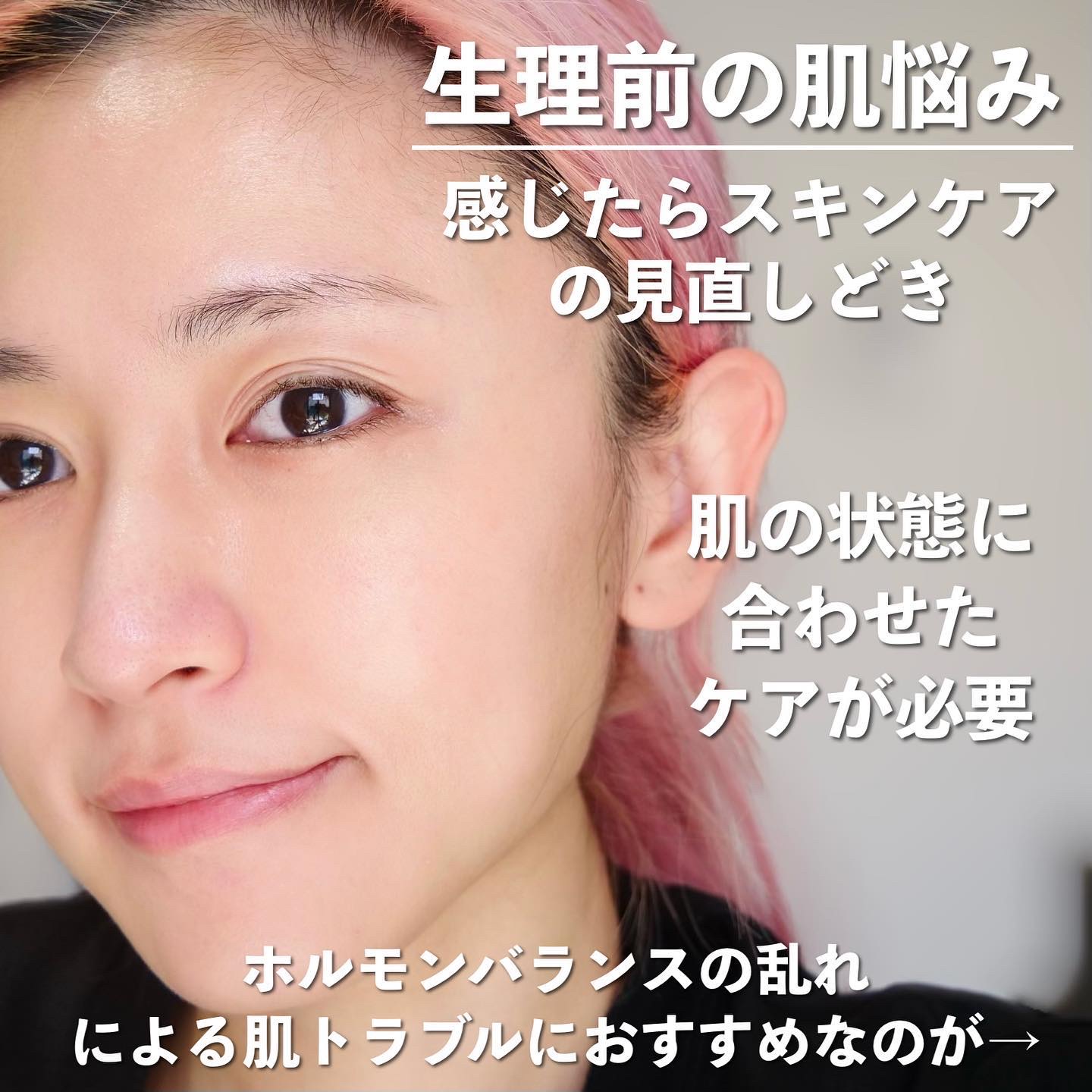 肌ラボ 薬用 極潤 スキンコンディショナーのクチコミ「＼肌トラブルに／隠れた名品、緑の極潤がおすすめ✨ 
 
◆───－- -　-　- -　-　.....」（2枚目）