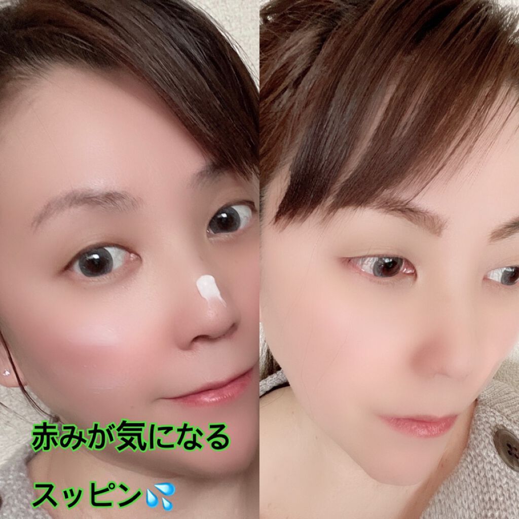 CICA ケアクリーム/BEAUSTA/フェイスクリームを使ったクチコミ(4枚目)