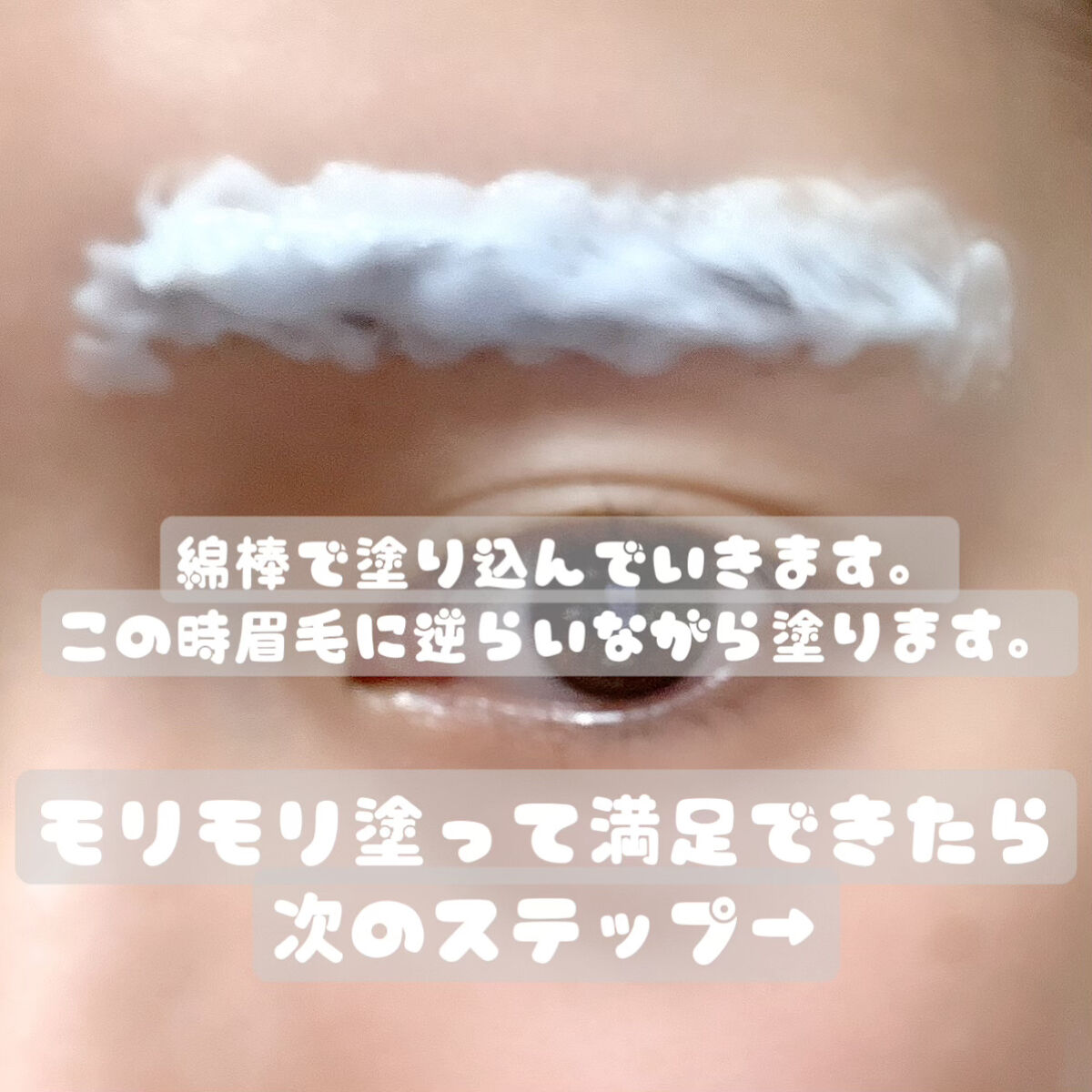 脱色クリーム 敏感肌用/エピラット/ムダ毛ケアを使ったクチコミ（3枚目）