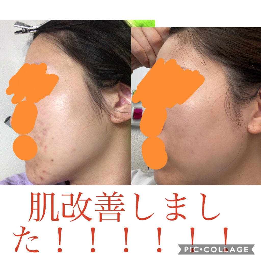 ファイバーフォーム/ルナメアAC/洗顔フォームを使ったクチコミ(1枚目)