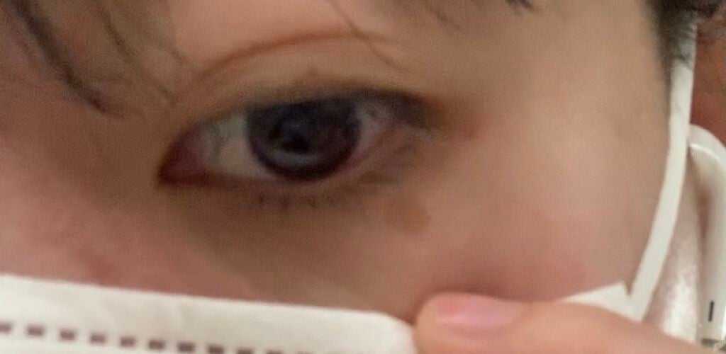 な on LIPS 「初投稿です。助けてください教えていただきたいです。昔から目にシ..」(1枚目)