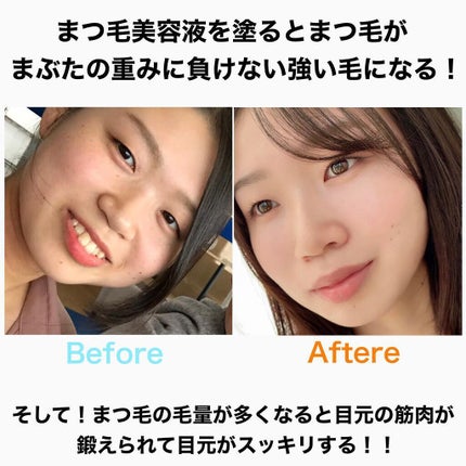 スカルプD ボーテ ピュアフリーアイラッシュセラム プレミアム/アンファー(スカルプD)/まつげ美容液を使ったクチコミ(6枚目)