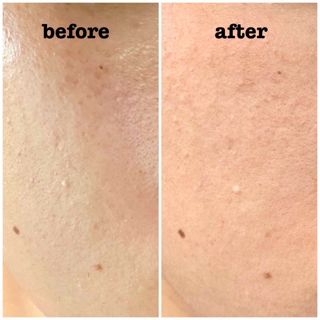 ほんのり色づくリップクリーム/レシピスト/リップケアを使ったクチコミ（2枚目）