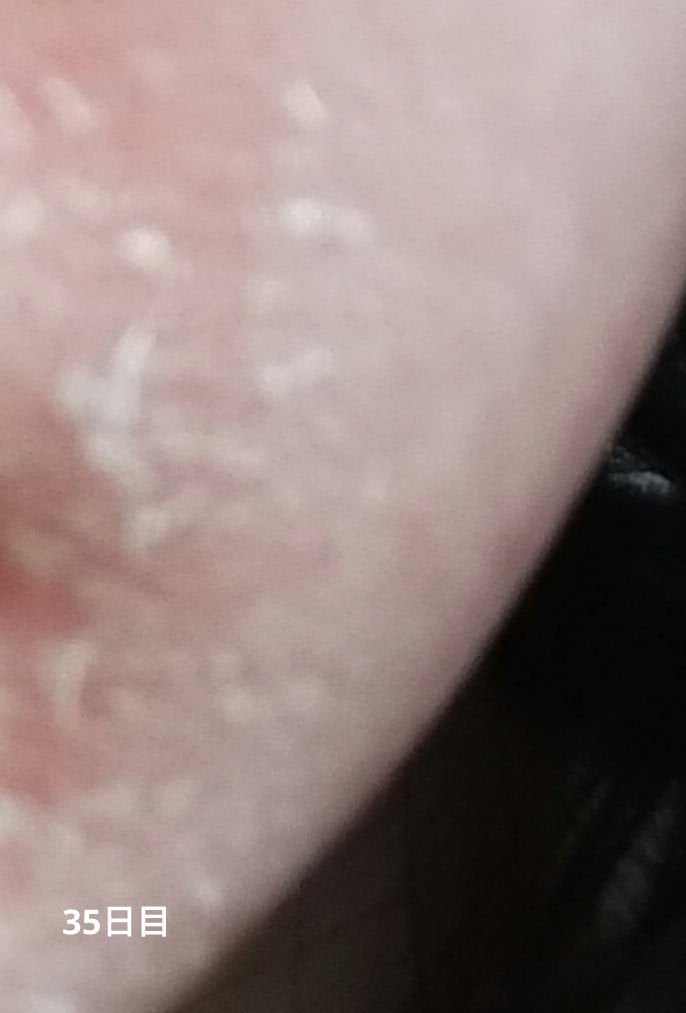 ミラミックス/ZO Skin Health/フェイスクリームを使ったクチコミ(5枚目)