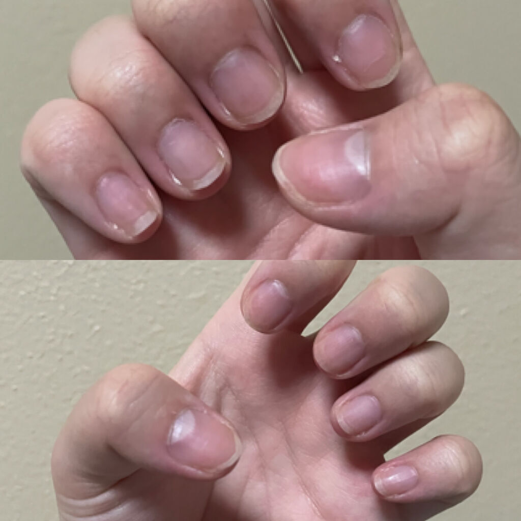 エテュセ クイックケアコート/ettusais/ネイルオイル・トリートメントを使ったクチコミ（2枚目）