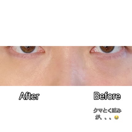 スーン クッションコンシーラー /エリザベス/クッションファンデーションを使ったクチコミ(9枚目)