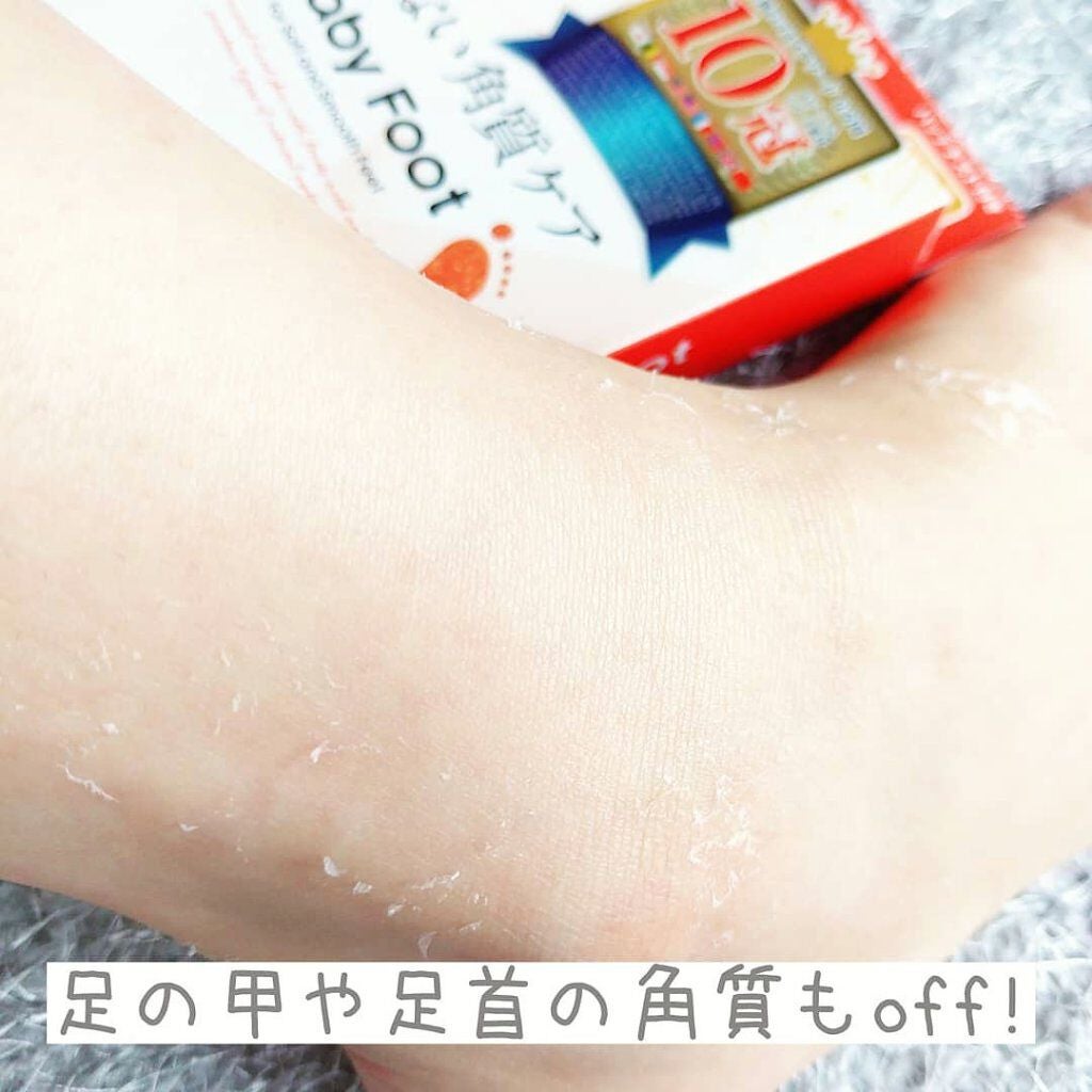 イージーパックDP60分タイプ/ベビーフット/レッグ・フットケアを使ったクチコミ(3枚目)
