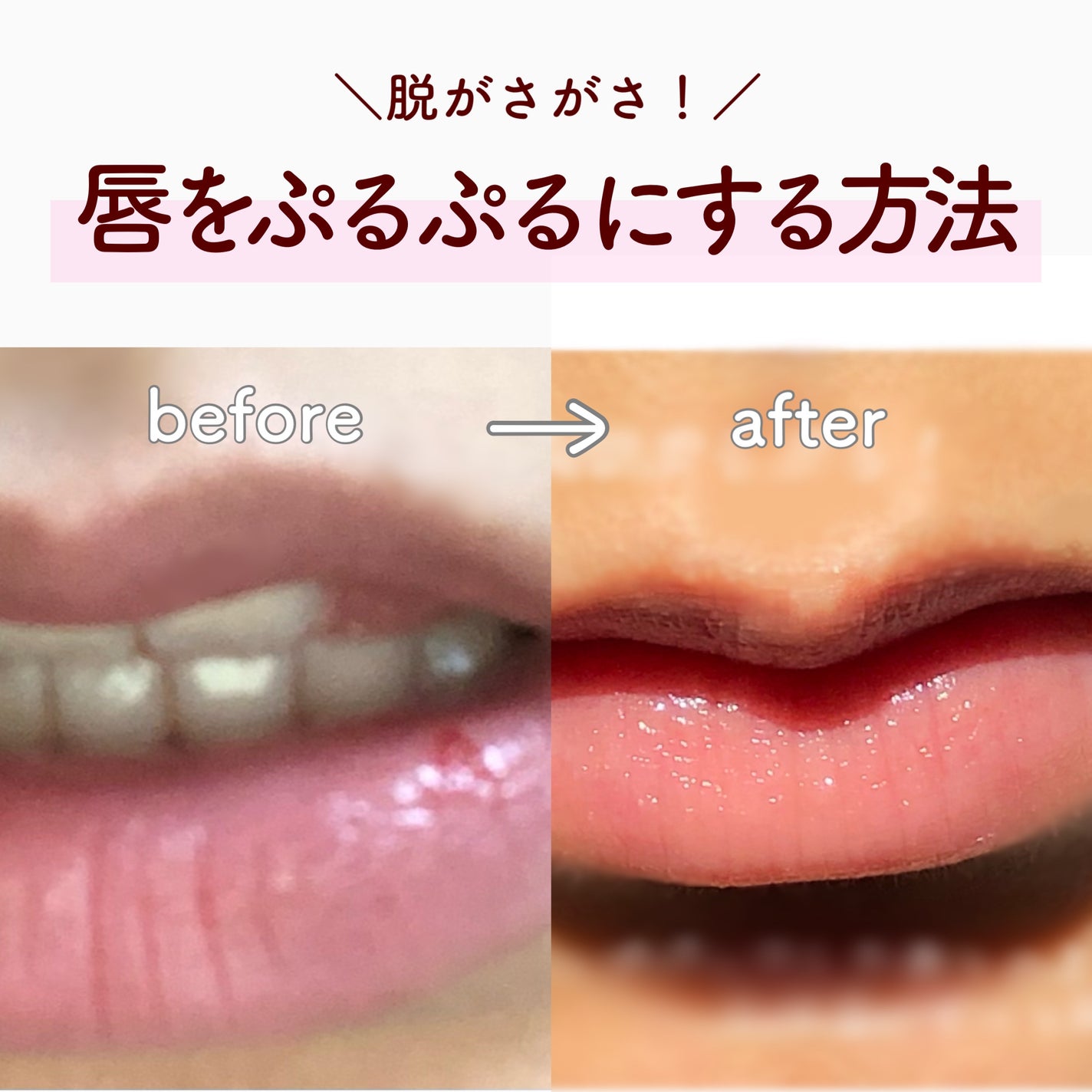 DHC 薬用リップクリーム/DHC/リップクリームを使ったクチコミ(1枚目)